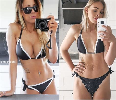 Influencer Says Shes Proud After Having Breast Implants Removed I Feel Like The Real Me
