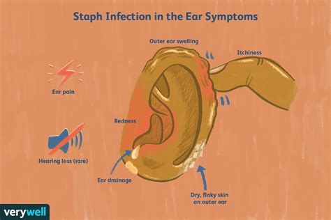 staph infection in the ear causes symptoms treatment