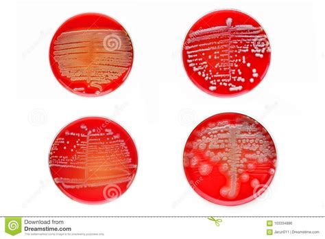 Bacteria Colonies Stock Photo Image Of Dish Colony 103334886