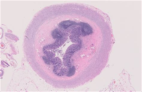 Appendix Normal Histology Nus Pathweb Nus Pathweb