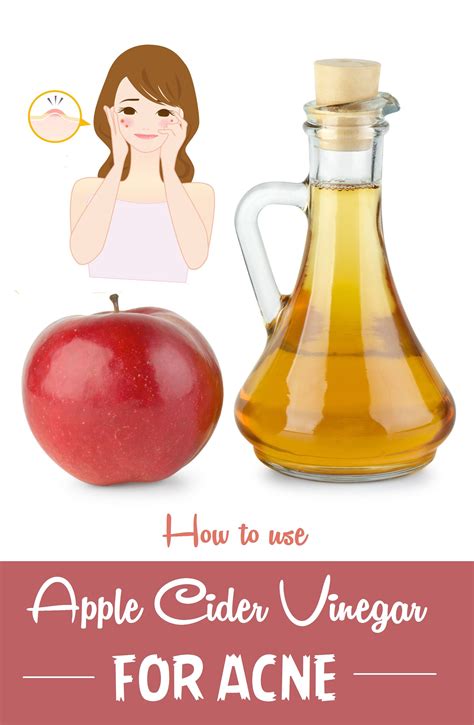 Apple Cider Vinegar For Acne Benefits And How To Use Vinegar For