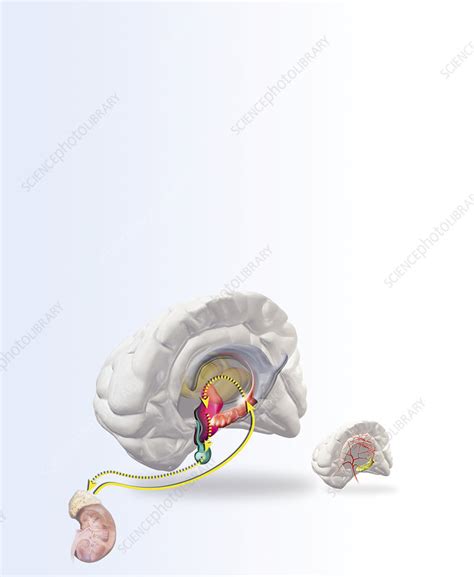 Depression Artwork Stock Image M1400417 Science Photo Library