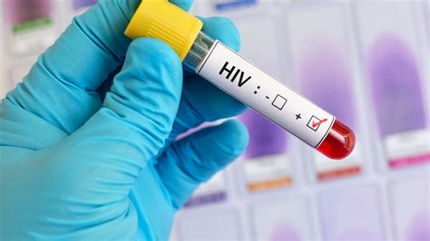 New Hiv Treatment Would Only Require Monthly Injection On Cheddar