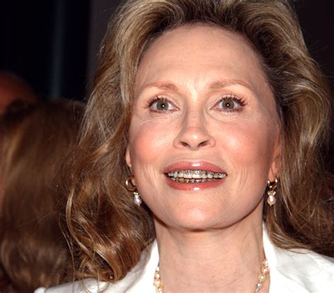 Famous Faces With Braces Celebrities With Braces Celebrity Smiles Faye Dunaway