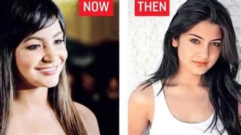 Bollywood Stars Cosmetic Surgery Before And After Youtube