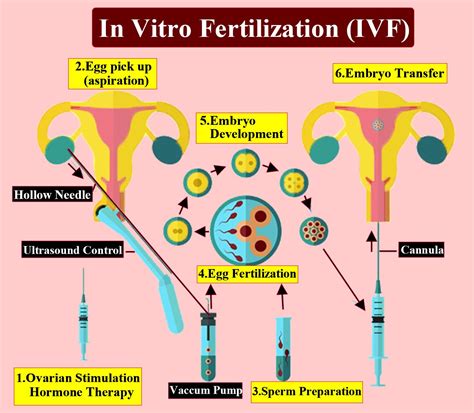 Suggest And Explain The Assisted Reproductive Techniques Which Will