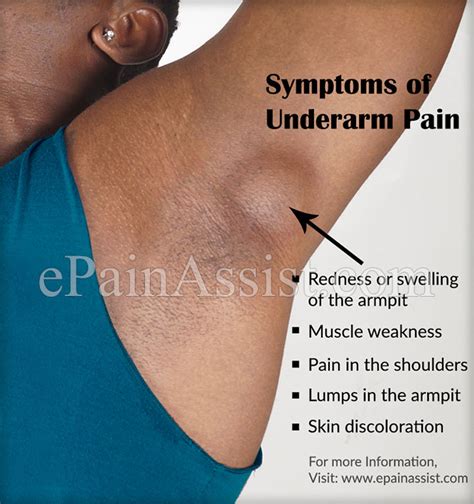 Underarm Pain Or Armpit Paincausessymptomstreatmenthome Remedies