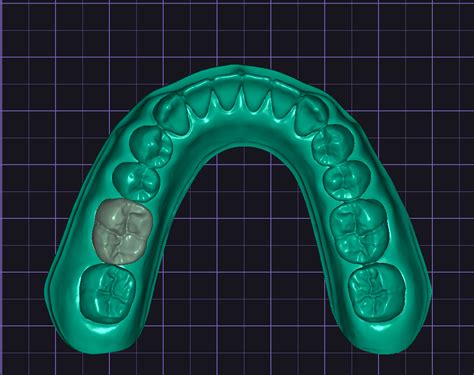 Stl File Dental Models And Dental Crown・3d Printer Design To Download・cults