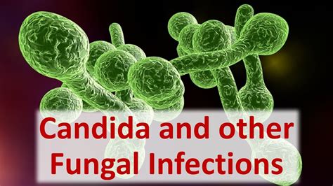 Solutions For Candida And Other Fungal Infections Youtube