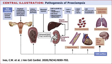 Preeclampsia—pathophysiology And Clinical Presentations Jacc State Of The Art Review Journal