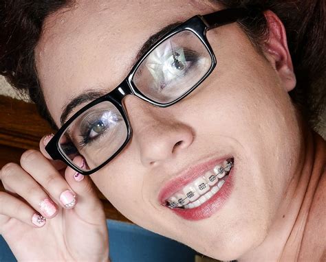 pin on braces and glasses