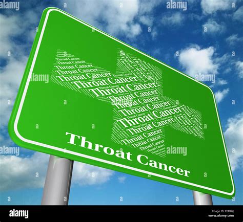 Throat Cancer Indicating Cancerous Growth And Signboard Stock Photo Alamy