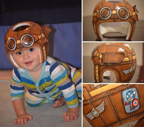 20 Cute And Fun Helmets For Babies With Plagiocephaly Baby Helmet