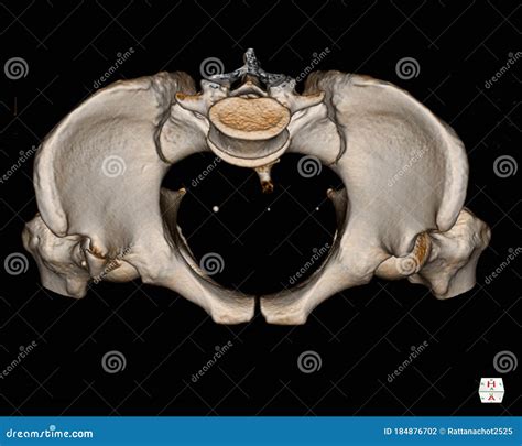 Ct Scan Pelvis Bone 3d Rendering Image Isolated On Black Background