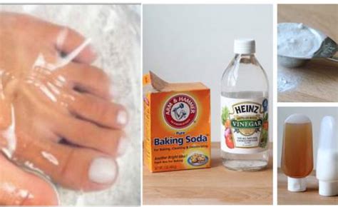 How To Cure Toenail Fungus For Good Id361182 By