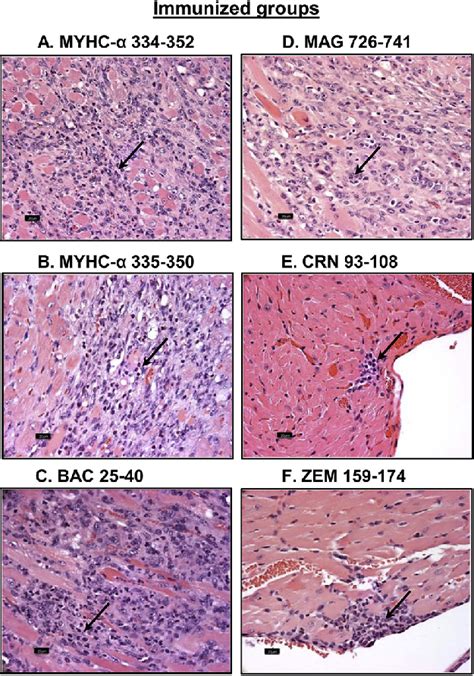Ropean society of cardiology working group on myocardial and pericar Histological evaluation of myocarditis induced by MYHC-a ...