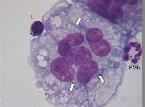 Multinucleate Giant Cell Lavaged From The Peritoneal Cavity Of A Mouse