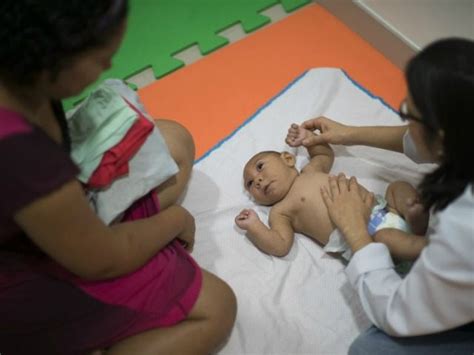 With zika virus expierenced some birth defect for the fetus. WHO Confirms: Zika Causes Brain Deformities