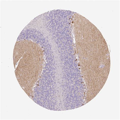 Your proteine atlas rat pics are be had in this web. Proteine Atlas Rat : Human Protein Atlas Webinars - Atlas ...
