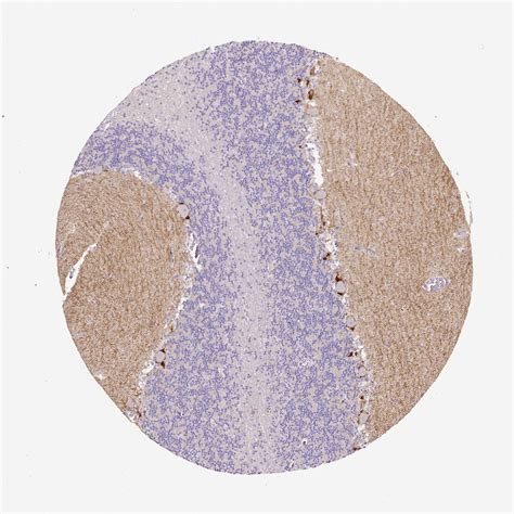 Once the protein atlas is more complete, meaning data of more proteins are integrated, we can study protein networks and identify hubs where all information comes together, or. Brain tissue expression of KIT - Mouse brain - The Human Protein Atlas