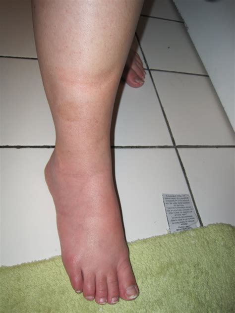 The Good Life: CANKLES