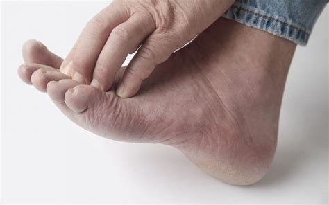 8 Useful Tips For Diabetic Foot Care Treatment Mvs Podiatry Associates