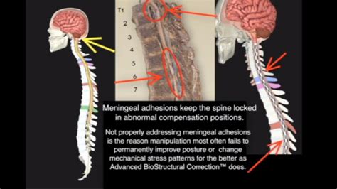 Meninges - The Missing Key to Unlocking Your Health