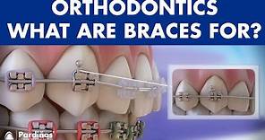 How Braces Work- Elements of the orthodontic treatment and its role ©
