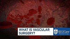What is Vascular Surgery?