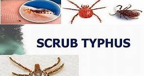 Scrub Typhus