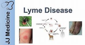 Lyme Disease | Pathophysiology, Signs, and Treatment