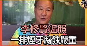 68歲李修賢蒼老難認，一排煙牙腐蝕嚴重，代言手遊晚節不保#周星馳