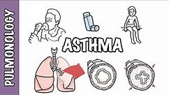 Understanding Asthma - pathophysiology and treatment