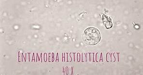 Entamoeba Histolytica cyst under microscope at 40X.