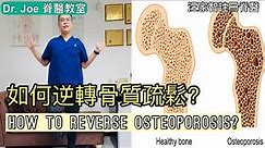 如何逆轉骨質疏鬆？ Dr Joe 教大家兩種方: 運動及營養[Eng Subtitles] How to Reverse Osteoporosis in 2 Steps.