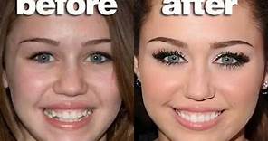 Miley Cyrus Teeth Before and After [Fake Tooth Surgery]