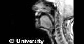 MRI voiceless alveolar fricative
