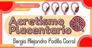 Acretismo Placentario (Sergio Alejandro Padilla Corral)