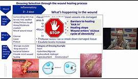 Understanding Wound Dressings Categories and Indications