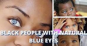 Black People with Natural Blue Eyes - Is it Possible?