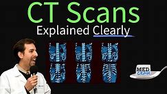 CT Scan of the Chest Explained Clearly - High Resolution CT Scan (HRCT)