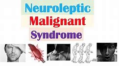 Neuroleptic Malignant Syndrome | Causes, Pathophysiology, Symptoms, Diagnosis, Treatment