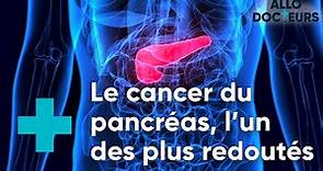 Cancer du pancréas, quels progrès ? - Le Magazine de la Santé