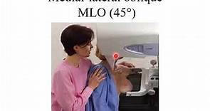 Mammography Narrated Video