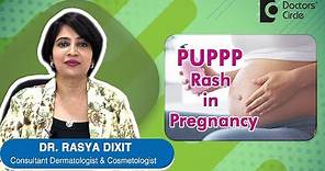 PUPPP Rash in Pregnancy Causes, Symptoms, Prevention & Treatment - Dr. Rasya Dixit | Doctors' Circle