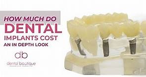 How Much Do Dental Implant's Cost | An In Depth Look Dental Boutique