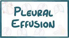 Pleural Effusion - causes, symptoms, diagnosis, treatment, pathology