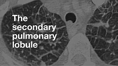 The Secondary Pulmonary Lobule