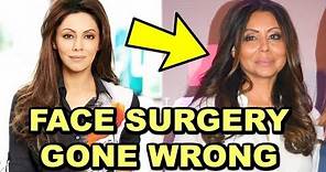 Gauri Khan Plastic Surgery Gone Wrong | SHOCKING Face Transformation