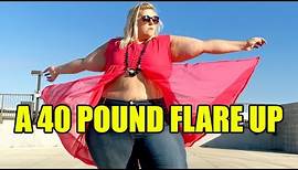 Anna OBrien And The Story Of The 40 Pound "Flare Up"